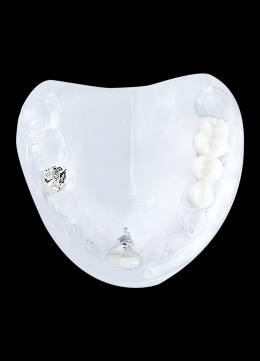 header-mobile-implantatbruecke-2