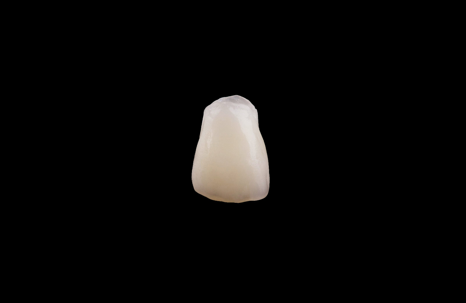 zahnersatz_imp_8 zahnersatz_imp_8