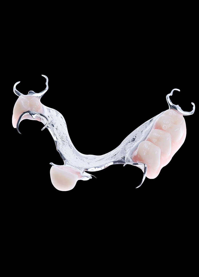 klammerprothese-3_mobile
